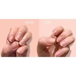 KurRidge Filler Fortifying 6 KurRidge Filler Fortifying -Mode- En Schoonheidswinkel l9mwef846729 1 dgl NL