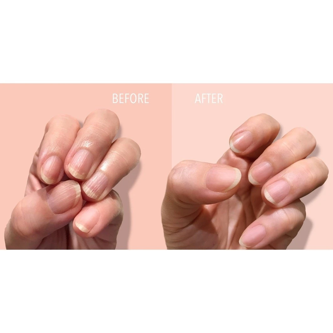 KurRidge Filler Fortifying 4 KurRidge Filler Fortifying - Afbeelding 2